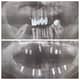 Slider image (9) Prestij Dental Clinic